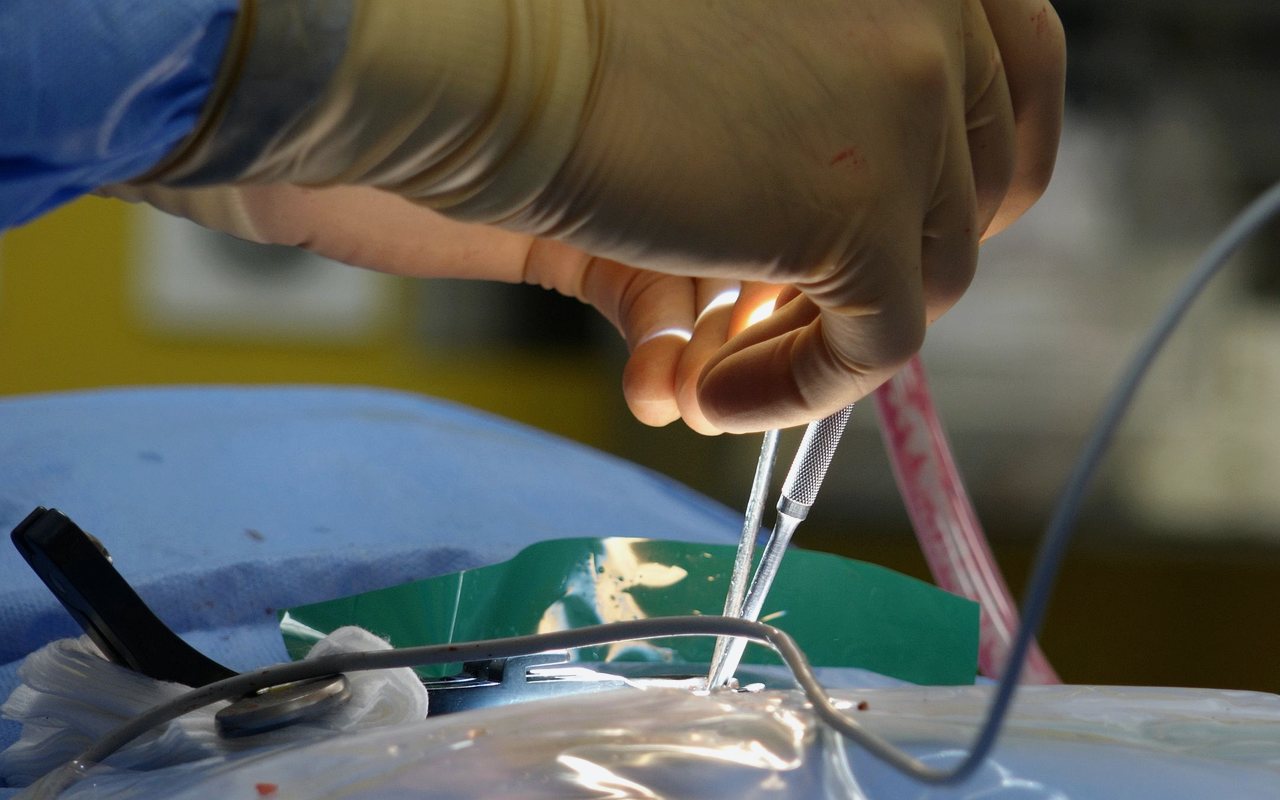 Clipaje de aneurisma cerebral en Tijuana con el Dr. Carlos A. Noreña Osterroth