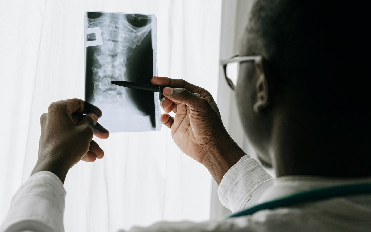 Discectomía cervical y artrodesis en Tijuana con el Dr. Carlos A. Noreña Osterroth