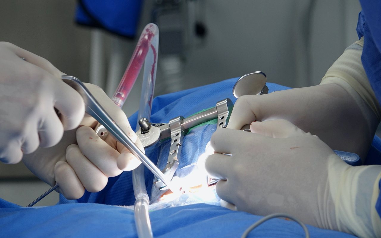 Laminectomía descompresiva en Tijuana con el Dr. Carlos A. Noreña Osterroth